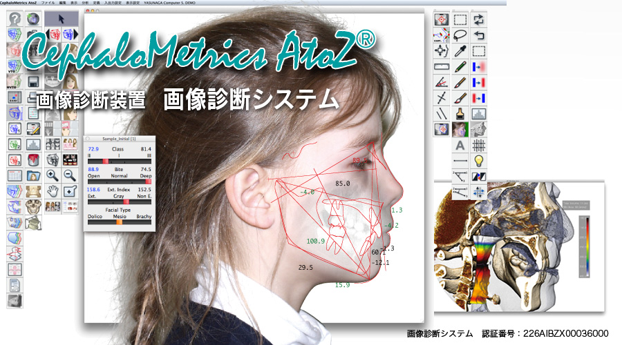 CephaloMetrics AtoZ Ver.16.5